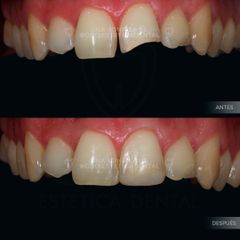 Rehabilitación - Dr. Lucas Matias Clerici