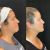 Botox, Excelente profesional , supee recomendable . Muchos conocimientos en el area
