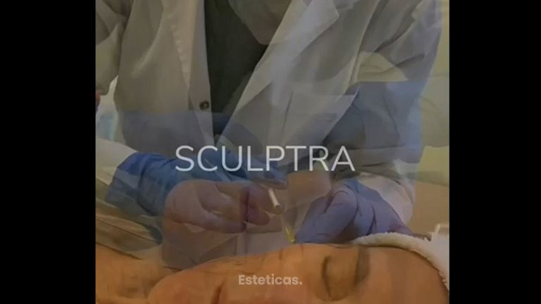 Sculptra - Dra Barbara Villanustre