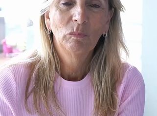 Botox - Estetica Casal