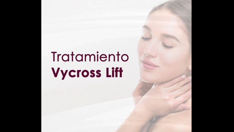 Tratamiento Vycross Lift - Dra. Hebe Blanco