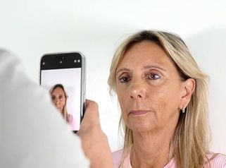 Botox - Estetica Casal