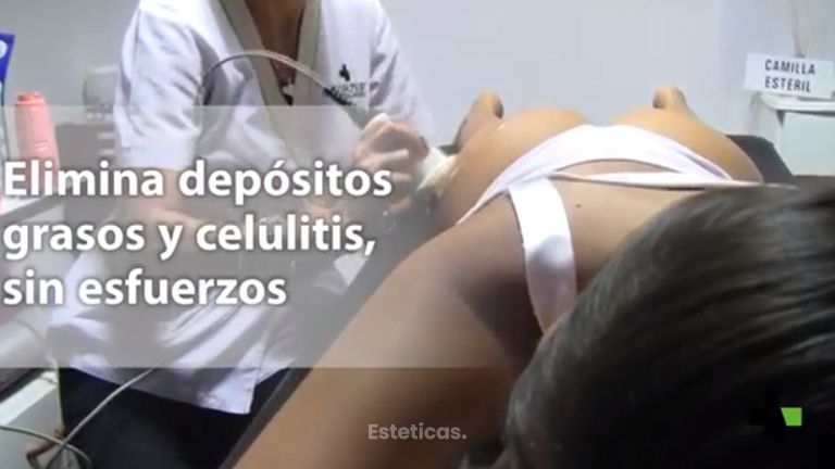 Ultracavitacióbn 