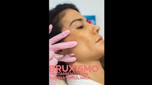 Bruxismo