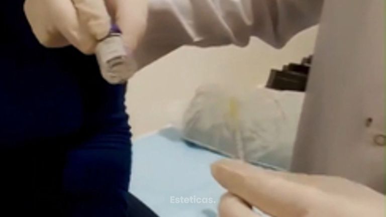 VENI APLICARTE BOTOX