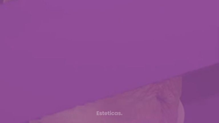 Abdominoplastia - post bariátrica - Dr. Emmanuel Manavela Chiapero