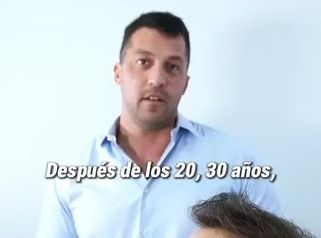 Alopecia - Estetica Casal